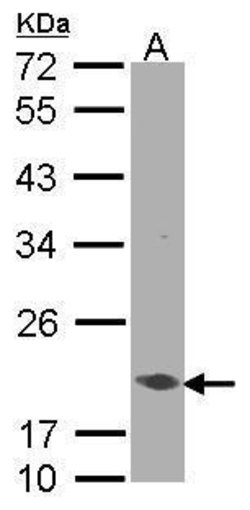 Invitrogen EEF1E1 Polyclonal Antibody 100 &mu;L; Unconjugated:Antibodies,