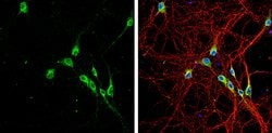 Invitrogen LGI1 Polyclonal Antibody 100 &mu;L; Unconjugated:Antibodies,