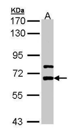 Invitrogen LGI1 Polyclonal Antibody 100 &mu;L; Unconjugated:Antibodies,