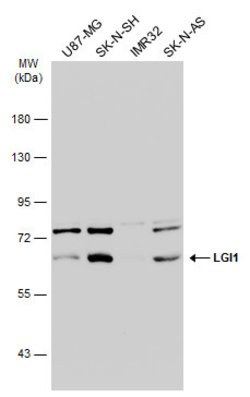 Invitrogen LGI1 Polyclonal Antibody 100 &mu;L; Unconjugated:Antibodies,