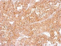 Invitrogen DR3 Polyclonal Antibody 100 &mu;L; Unconjugated:Antibodies,