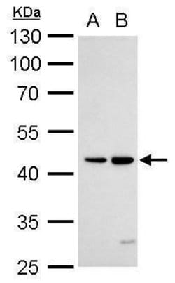 Invitrogen DR3 Polyclonal Antibody 100 &mu;L; Unconjugated:Antibodies,
