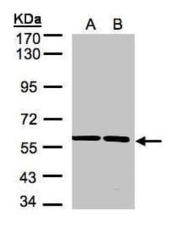 Invitrogen SRPR Polyclonal Antibody 100 &mu;L; Unconjugated:Antibodies,