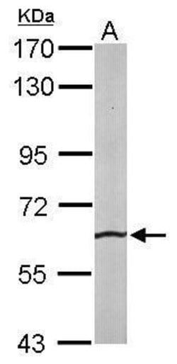 Invitrogen SRPR Polyclonal Antibody 100 &mu;L; Unconjugated:Antibodies,