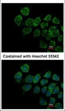 Invitrogen IFNAR2 Polyclonal Antibody 100 &mu;L; Unconjugated:Antibodies,