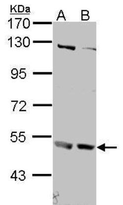 Invitrogen IFNAR2 Polyclonal Antibody 100 &mu;L; Unconjugated:Antibodies,