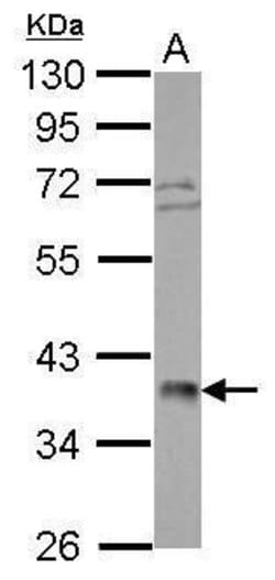Invitrogen POLR3F Polyclonal Antibody 100 &mu;L; Unconjugated:Antibodies,