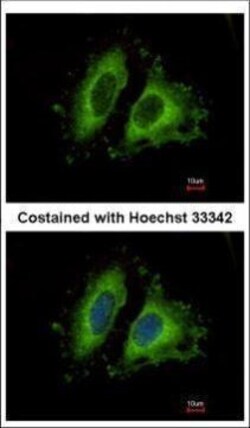 Invitrogen GIT1 Polyclonal Antibody 100 &mu;L | Buy Online | Invitrogen&trade; | Fisher Scientific
