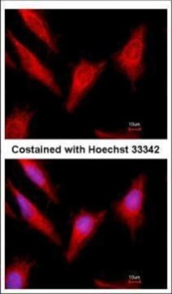 Invitrogen Protein C Polyclonal Antibody 100 &mu;L; Unconjugated:Antibodies,