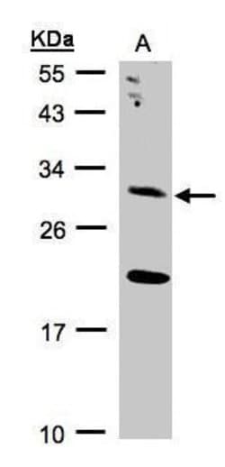 Invitrogen UROS Polyclonal Antibody 100 &mu;L; Unconjugated:Antibodies,