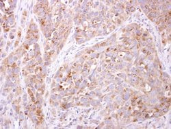 Invitrogen ETNK1 Polyclonal Antibody 100 &mu;L; Unconjugated:Antibodies,