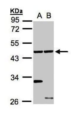 Invitrogen ETNK1 Polyclonal Antibody 100 &mu;L; Unconjugated:Antibodies,
