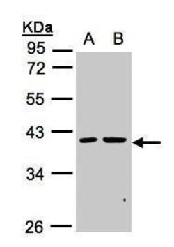 Invitrogen PSKH2 Polyclonal Antibody 100 &mu;L | Buy Online | Invitrogen&trade; | Fisher Scientific