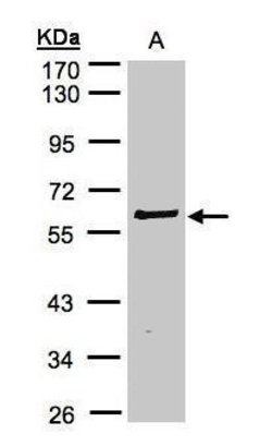 Invitrogen RIP2 Polyclonal Antibody 100 &mu;L; Unconjugated:Antibodies,