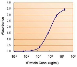 Invitrogen Monoamine Oxidase B Polyclonal Antibody 100 &mu;L; Unconjugated:Antibodies,