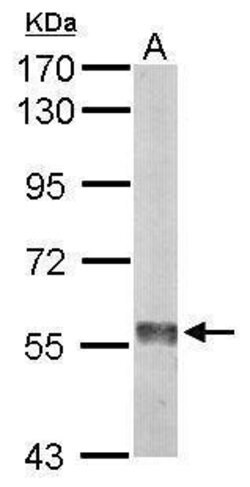 Invitrogen Monoamine Oxidase B Polyclonal Antibody 100 &mu;L; Unconjugated:Antibodies,