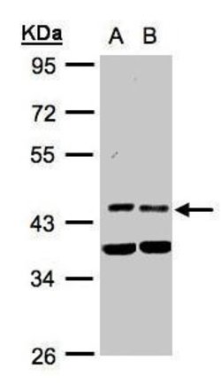 Invitrogen PDK1 Polyclonal Antibody 100 &mu;L | Buy Online | Invitrogen&trade; | Fisher Scientific