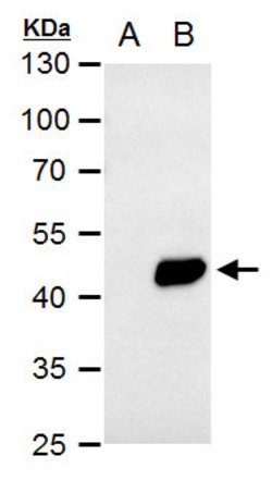 Invitrogen PDK1 Polyclonal Antibody 100 &mu;L | Buy Online | Invitrogen&trade; | Fisher Scientific