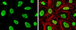 RAD21 Polyclonal Antibody, Invitrogen 100 &mu;L; Unconjugated:Antibodies,