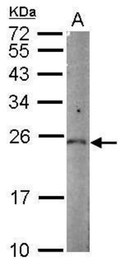 Invitrogen PGPEP1 Polyclonal Antibody 100 &mu;L; Unconjugated:Antibodies,
