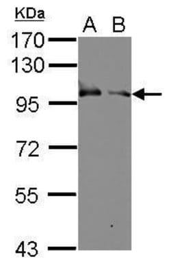 Invitrogen KELL Polyclonal Antibody 100 &mu;L | Buy Online | Invitrogen&trade; | Fisher Scientific