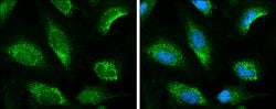 Invitrogen KEAP1 Polyclonal Antibody 100 &mu;L; Unconjugated:Antibodies,