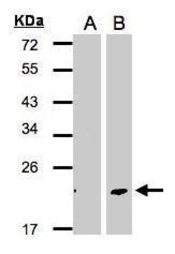 Invitrogen DPT Polyclonal Antibody 100 &mu;L; Unconjugated:Antibodies,