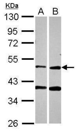 Invitrogen PPOX Polyclonal Antibody 100 &mu;L; Unconjugated:Antibodies,