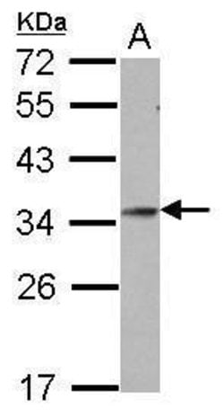 Invitrogen GSC Polyclonal Antibody 100 &mu;L; Unconjugated:Antibodies,