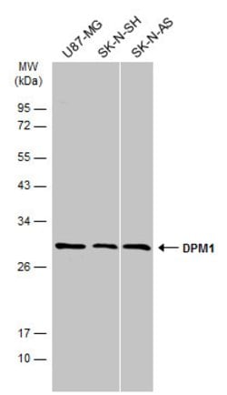 Invitrogen DPM1 Polyclonal Antibody 100 &mu;L | Buy Online | Invitrogen&trade; | Fisher Scientific