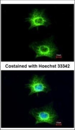 Invitrogen WNK1 Polyclonal Antibody 100 &mu;L | Buy Online | Invitrogen&trade; | Fisher Scientific