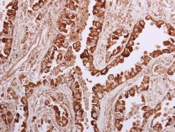 Invitrogen WNK1 Polyclonal Antibody 100 &mu;L | Buy Online | Invitrogen&trade; | Fisher Scientific