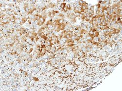 Invitrogen WNK1 Polyclonal Antibody 100 &mu;L | Buy Online | Invitrogen&trade; | Fisher Scientific