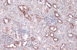 Invitrogen WNK1 Polyclonal Antibody 100 &mu;L | Buy Online | Invitrogen&trade; | Fisher Scientific