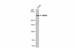 Invitrogen WNK1 Polyclonal Antibody 100 &mu;L | Buy Online | Invitrogen&trade; | Fisher Scientific
