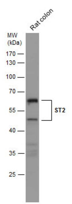 Invitrogen ST2 Polyclonal Antibody 100 &mu;L; Unconjugated:Antibodies,