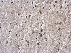 Invitrogen hnRNP A1 Polyclonal Antibody 100 &mu;L; Unconjugated:Antibodies,