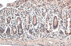 Invitrogen ESRRA Polyclonal Antibody 100 &mu;L; Unconjugated:Antibodies,