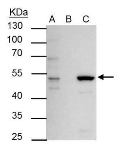Invitrogen ESRRA Polyclonal Antibody 100 &mu;L; Unconjugated:Antibodies,