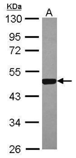 Invitrogen ESRRA Polyclonal Antibody 100 &mu;L; Unconjugated:Antibodies,