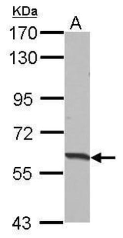 Invitrogen HABP2 Polyclonal Antibody 100 &mu;L | Buy Online | Invitrogen&trade; | Fisher Scientific