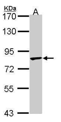 Invitrogen TRIM36 Polyclonal Antibody 100 &mu;L; Unconjugated:Antikroppar