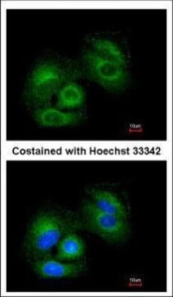 Invitrogen SIRT3 Polyclonal Antibody 100 &mu;L | Buy Online | Invitrogen&trade; | Fisher Scientific