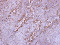 Invitrogen SIRT3 Polyclonal Antibody 100 &mu;L; Unconjugated:Antibodies,