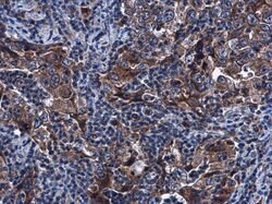 Invitrogen SIRT3 Polyclonal Antibody 100 &mu;L; Unconjugated:Antibodies,