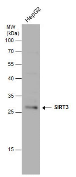 Invitrogen SIRT3 Polyclonal Antibody 100 &mu;L; Unconjugated:Antibodies,