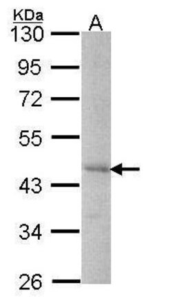 DYX1C1 Polyclonal Antibody, Invitrogen 100 &mu;L; Unconjugated:Antibodies,