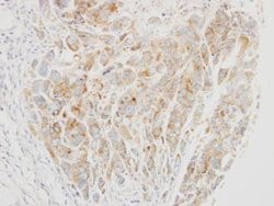 Invitrogen VPS26A Polyclonal Antibody 100 &mu;L | Buy Online | Invitrogen&trade; | Fisher Scientific