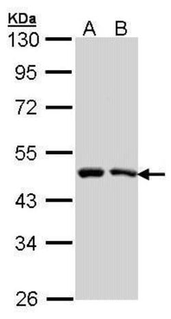 Invitrogen SIL1 Polyclonal Antibody 100 &mu;L | Buy Online | Invitrogen&trade; | Fisher Scientific