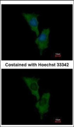 Invitrogen ELMO1 Polyclonal Antibody 100 &mu;L | Buy Online | Invitrogen&trade; | Fisher Scientific